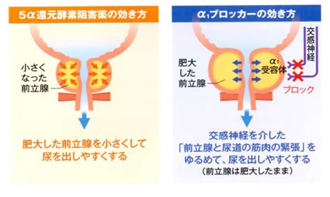 前立腺肥大症の治療薬 医療法人社団 玲瓏会 金町中央病院