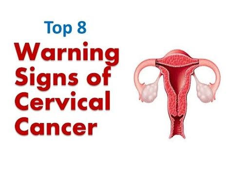 Cervical Cancer Symptoms Warning Signs