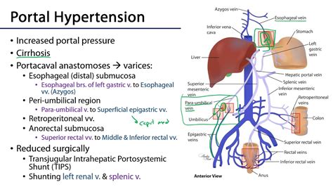 Hepatic Portal System M1 S10 Stomach Liver And Spleen Youtube