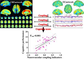 Neurovascular Decoupling In Type Diabetes Mellitus Without Mild