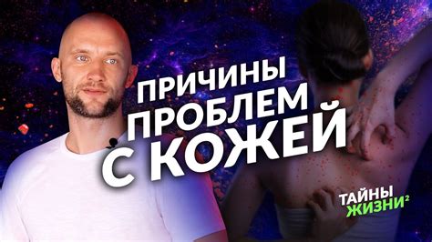 ИЗЛЕЧИ СЕБЯ! ЦЕЛИТЕЛЬ РАССКАЗАЛ О СКРЫТЫХ ПРИЧИНАХ ПРОБЛЕМ С КОЖЕЙ И ...