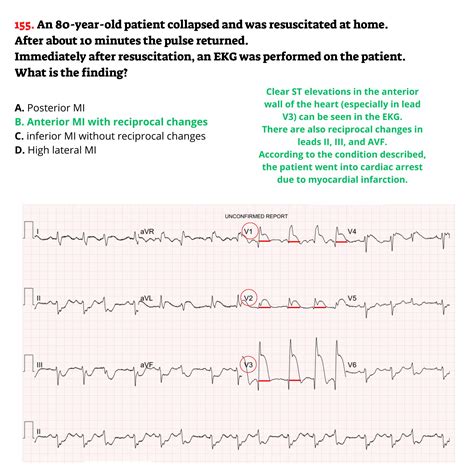 Pharmacology Template Cheat Sheet EKG Practice Test 250 Questions ...