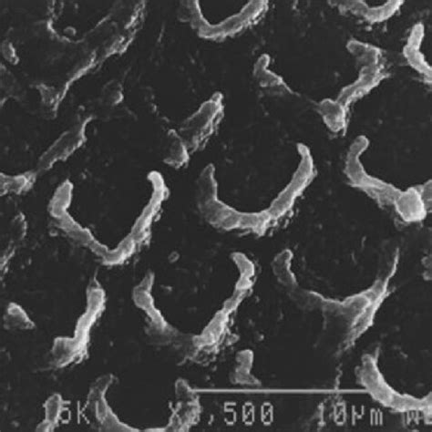 Scanning Electron Microscopic Microphotograph At 3500 Representative