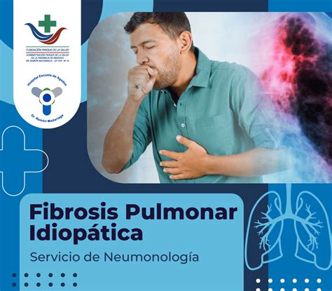 Fibrosis Pulmonar Idiop Tica El Diagn Stico Temprano Es Esencial Para