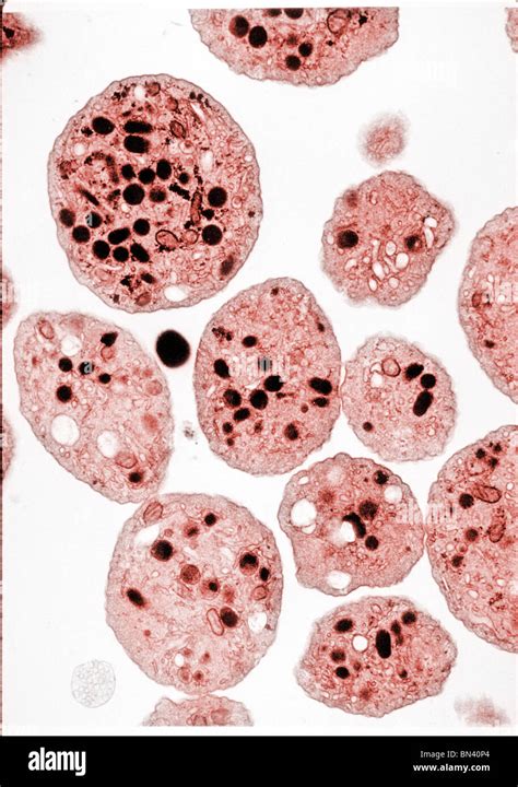 Transmission Electron Microscope TEM Image Of Human Platelets Stock