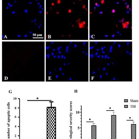 Neuronal Apoptosis In Tbi Rats Ac And Df Is To Show The Apoptosis