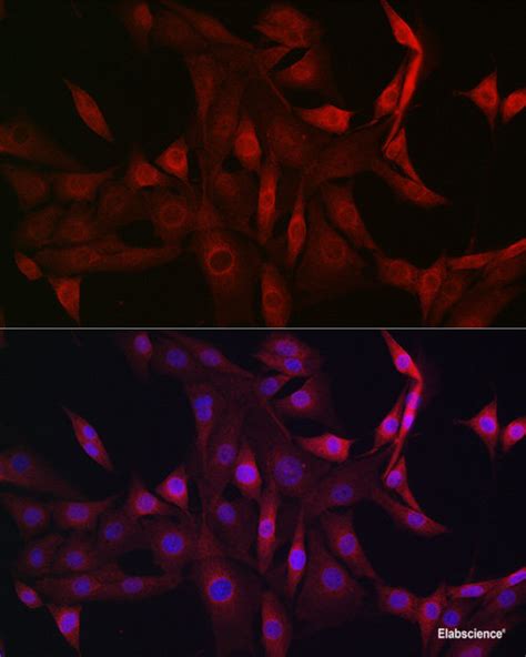 High Affinity And Specificity KO Validated STAT5B Polyclonal Antibody