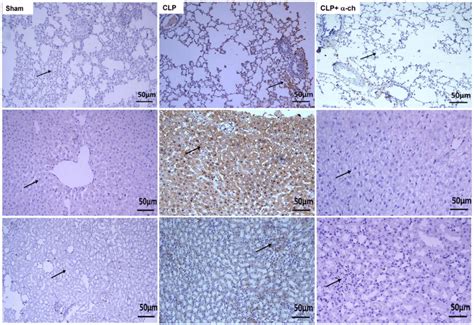 Protective effect of alpha-chymotrypsin against sepsis-induced high MPO ...