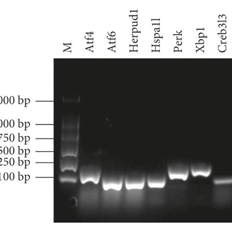 Determination Of Differentially Expressed Genes In Upr Pathways In The