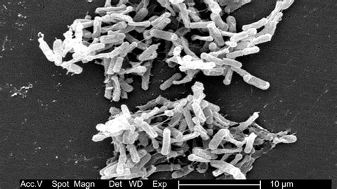 Clostridium Tetani Bacteria Britannica