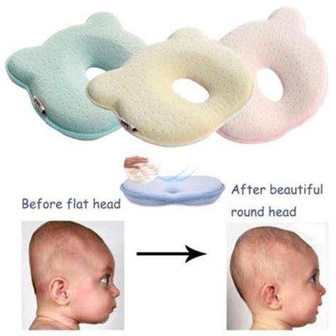 baby soft spot on head - Cultivated Online Diary Efecto