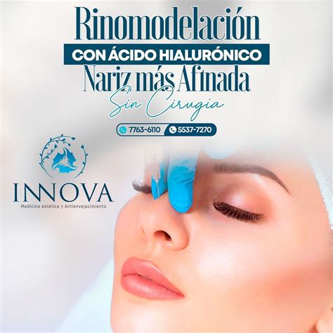 Servicios Innova Medicina Estetica