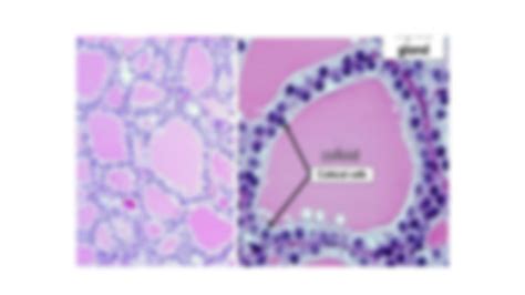 Solution Histology Epithelium Simple Squamous Epithelium Studypool