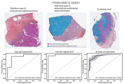 Diagnostics Free Full Text Deep Learning Based Classification Of Uterine Cervical And