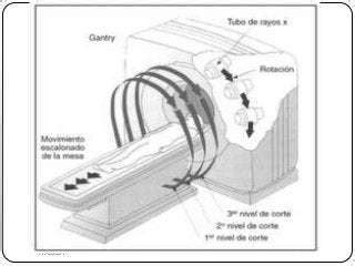 Tomograf A Computarizada M Todos De Adquisici N Mind Map