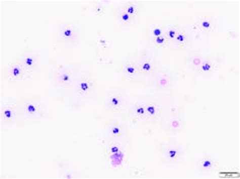 Cytology Of Joint Fluid From A Dog With Impa Non Degenerate