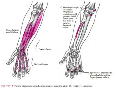 Extrinsic Muscle Tendons Of The Hand Flashcards Quizlet Hot Sex Picture