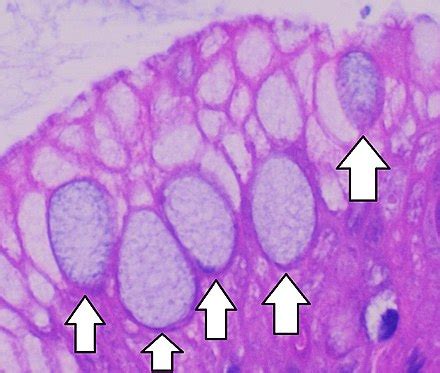 Goblet cell - Wikipedia