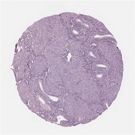 Tissue Expression Of Paep Staining In Endometrium The Human Protein