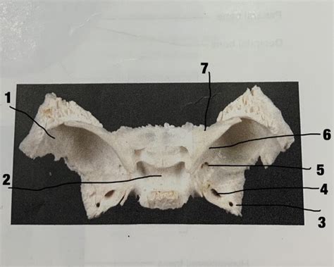 Sphenoid Bone Flashcards Quizlet