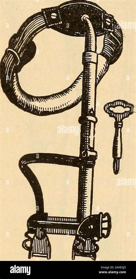 Lectures On Orthopedic Surgery Fig 104 The Henry G Davis Hip