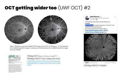 Next Gen Ophthalmic Imaging For Neurodegenerative Diseases And