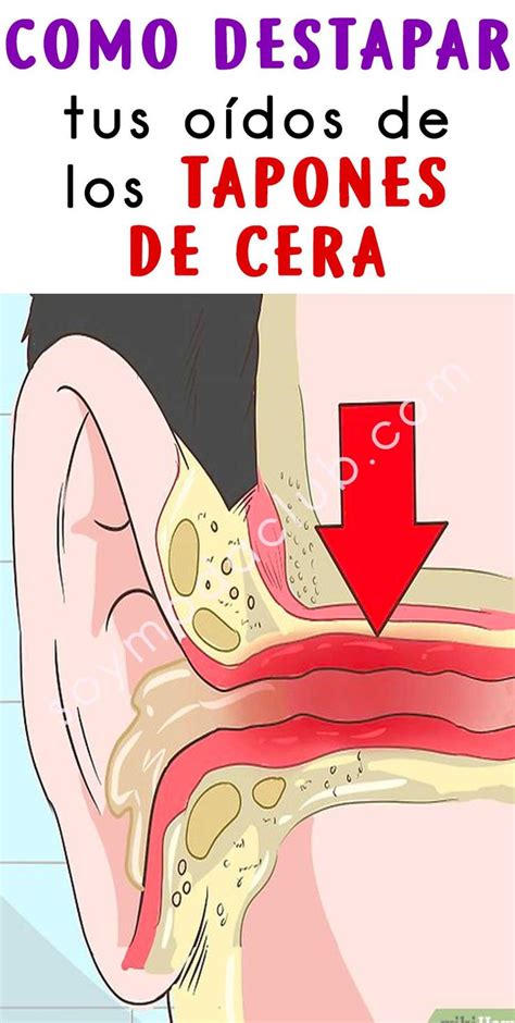 Destapa tus oídos de los tapones de cera Consejos para la salud