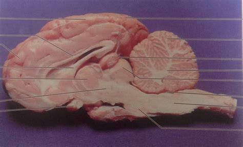 Sheep Brain Pineal Gland Frontal Lobe Diagram Quizlet