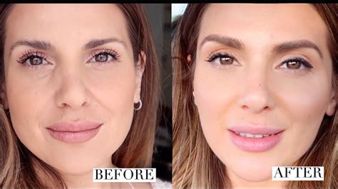 How I Got Rid Of Under Eye Hollows And Improved My Overall Look Ali