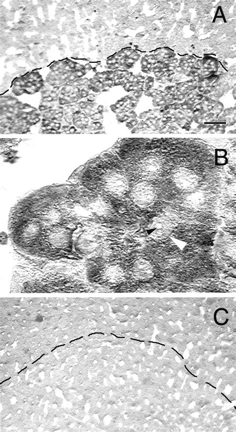 Sex Steroid Regulation Of The Inflammatory Response Sympathoadrenal Dependence In The Female