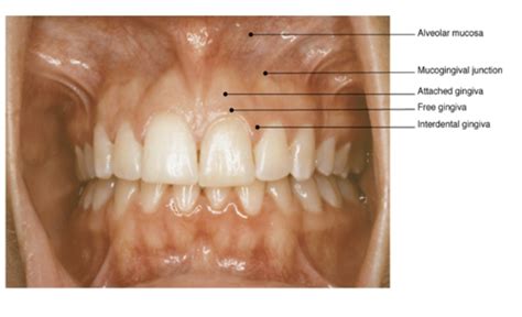 Periodontium The Tooth Supporting Structures Flashcards Quizlet