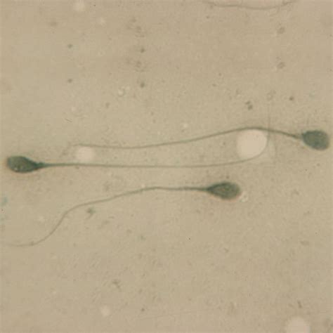 Sperm Microscope Slide