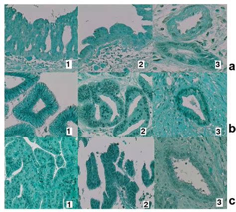 Figure 3 Immunohistochemical Expression Of Sex Steroid Hormone