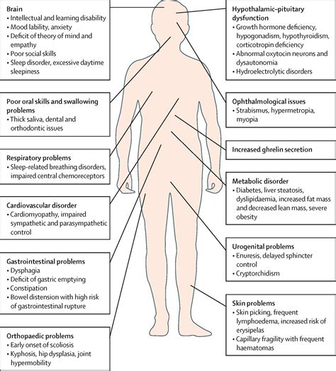 Endocrine disorders in Prader-Willi syndrome: a model to understand and