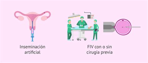 DOLOR de OVARIOS SIN MENSTRUACIÓN SOLUCIONES EFECTIVAS