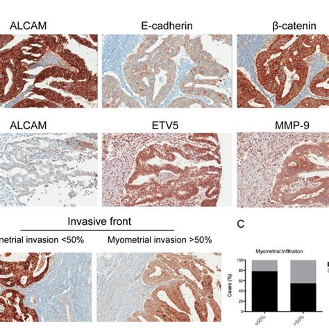 Alcam Expression Presented A Different Correlation Profile Depending On Download Scientific