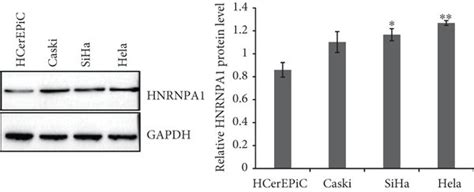 Knockdown of HNRNPA1 attenuated the proliferation, invasion, and ... 
