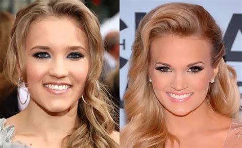 Carrie Underwood Nose Job Plastic Surgery Before and After | Celebie
