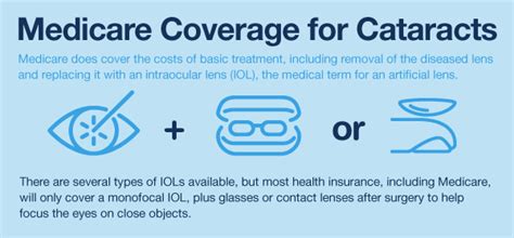 When Does Medicare Cover Cataract Surgery And How Much Artofit