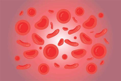 Microcytic Anemia: What Is Microcytic Anemia?