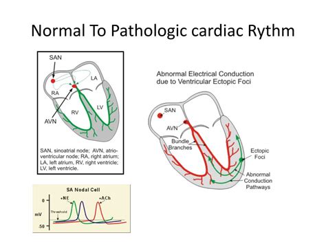 Ppt Antiarrhythmic Drugs Powerpoint Presentation Free Download Id 1012629