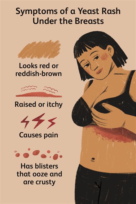 Rash Under Breast Causes Treatment And Prevention 49 OFF