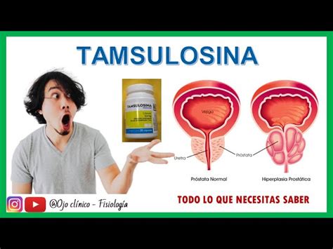 【tamsulosina Para Que Sirve】dosis Contraindicaciones ️