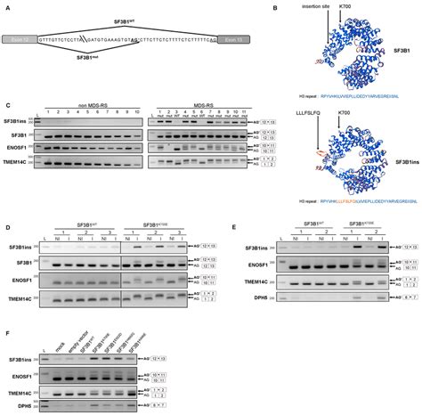 A Novel Splicing Isoform Of Sf3b1 Sf3b1ins Is Detected In