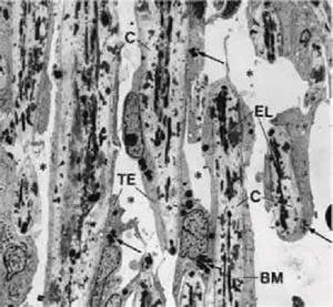 Trabecular Meshwork Anatomy