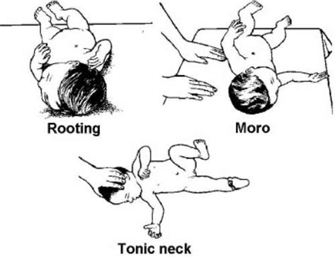 B Common Infant Reflexes See Figure 7 8 1 Rooting The Infant