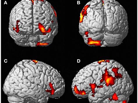 Brain During An Out Of Body Experience Business Insider