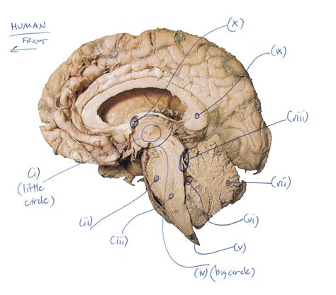 brain anatomy side diagram quizlet