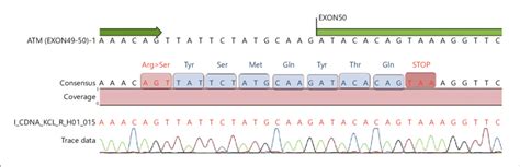 Sanger sequencing of the ATM gene exons 49-50. | Download Scientific ... 