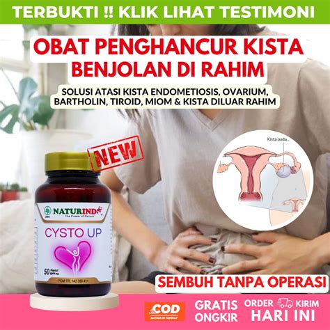 Jual Obat Kista Ovarium Barthoolin Ganglion Miom Myom Yg Paling Ampuh